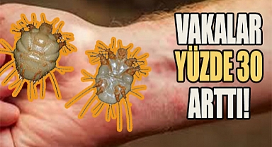 Uyuz salgınına dikkat!