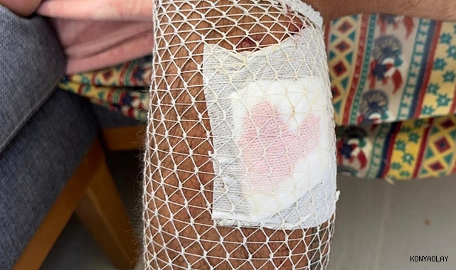 Yürüyüş yaparken köpek saldırısında yaralandı