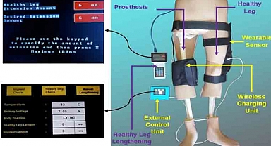 Türk akademisyenler, kemik kanseri tedavisi için tümör protezi geliştirdi