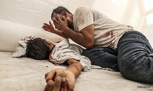 Gazze'de can kaybı 67 bin 806’ya yükseldi