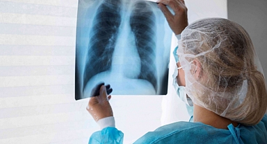 Erken tanı akciğer kanserinde hayati önem taşıyor