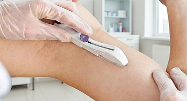 Kol Altı İmplant Nedir?