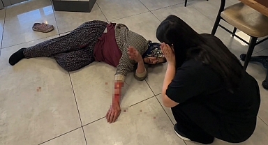 Tekmelere aldırmayan köpek kadının kolunu kopardı